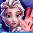 Elsa Hand Surgery