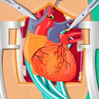 Heart Surgery