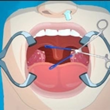 Play Operate Now: Tonsil Surgery Online