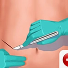 Play Appendix Surgery Online