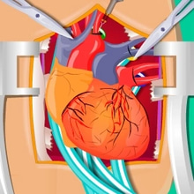 Play Heart Surgery Online